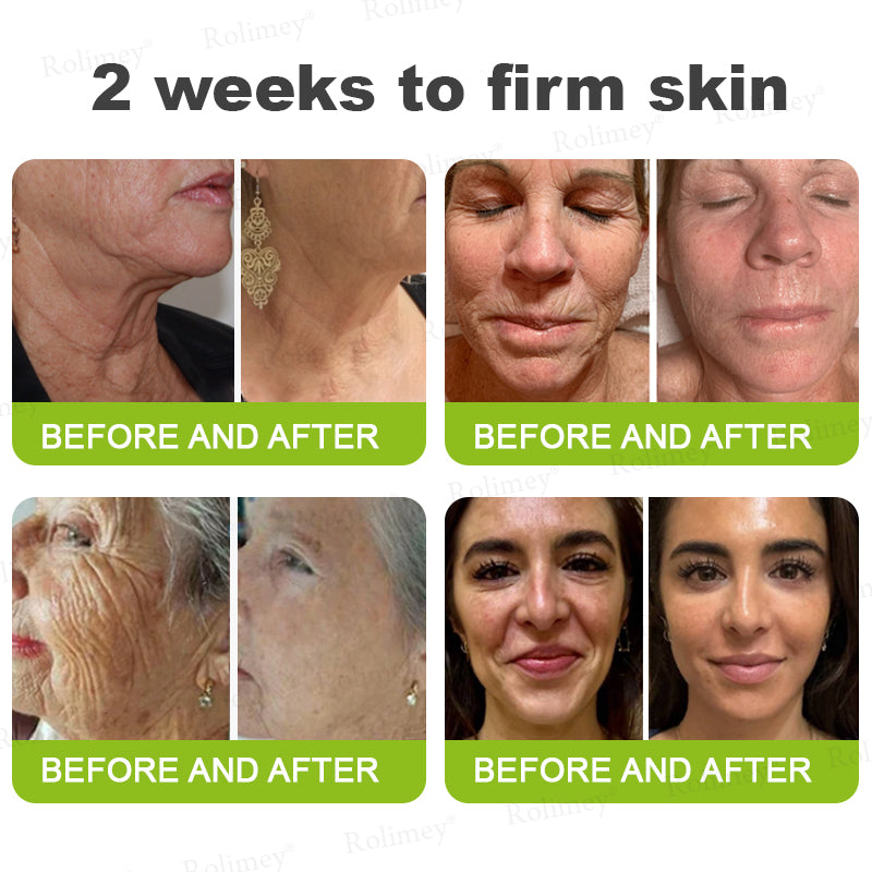 Botox & Vita A Retinol Shot Wrinkle-Lift Tightening cream