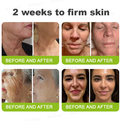 Botox & Vita A Retinol Shot Wrinkle-Lift Tightening cream