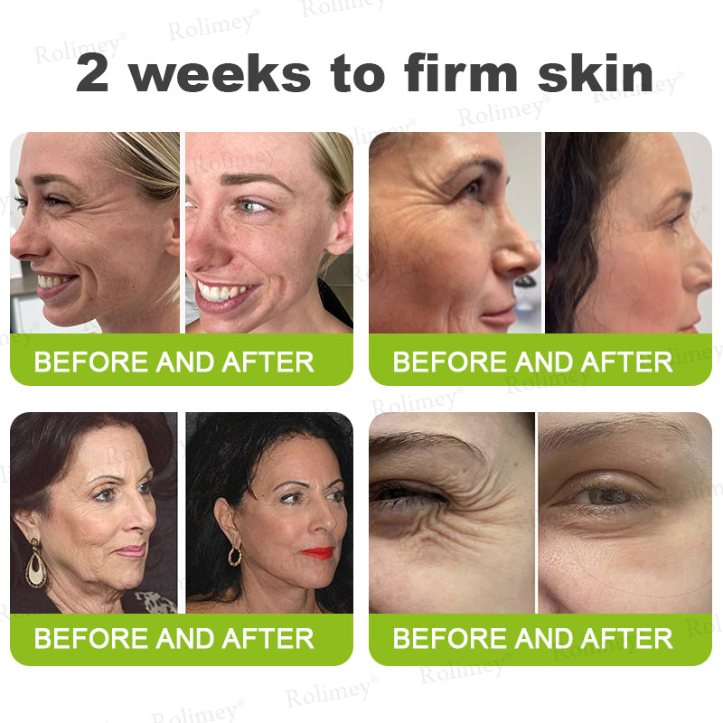 Botox & Vita A Retinol Shot Wrinkle-Lift Tightening cream