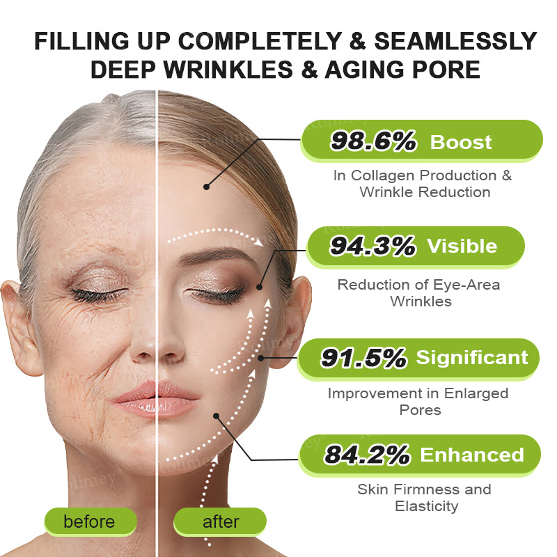 Botox & Vita A Retinol Shot Wrinkle-Lift Tightening cream