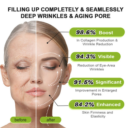 Botox & Vita A Retinol Shot Wrinkle-Lift Tightening cream