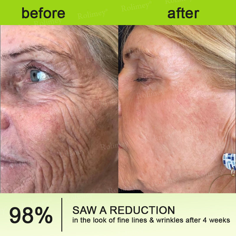 Botox & Vita A Retinol Shot Wrinkle-Lift Tightening cream