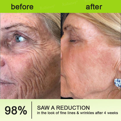 Botox & Vita A Retinol Shot Wrinkle-Lift Tightening cream