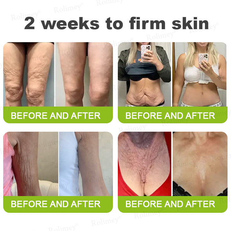 Botox & Vita A Retinol Shot Wrinkle-Lift Tightening cream
