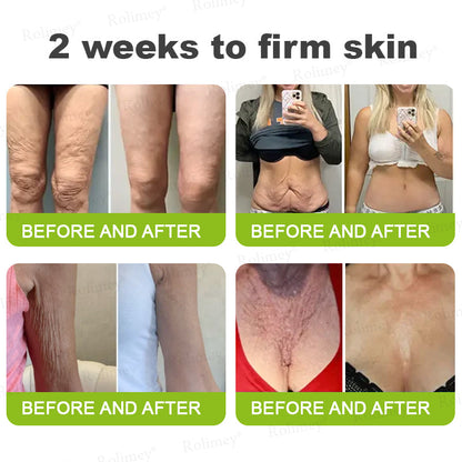 Botox & Vita A Retinol Shot Wrinkle-Lift Tightening cream