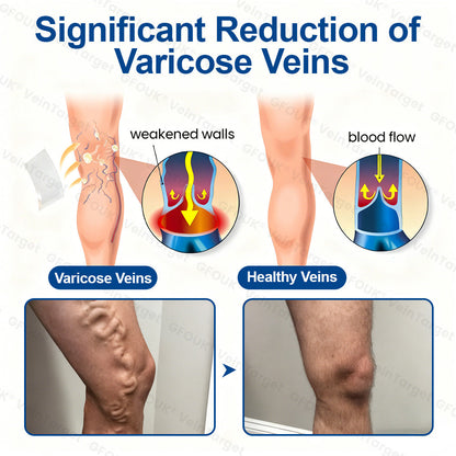 🇺🇸✅VeinTarget Microneedle Patch⚡Instant Relief, Long-Term Results