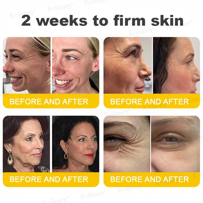 Wrinkle-Lift⬆️ Botox & Vita A Retinol Shot Tightening cream