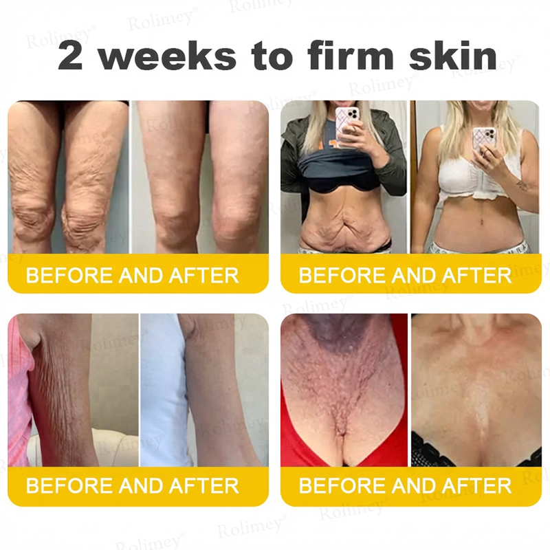 Wrinkle-Lift⬆️ Botox & Vita A Retinol Shot Tightening cream