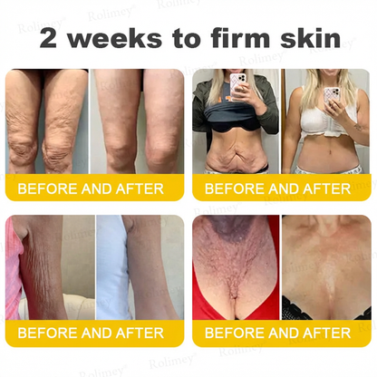 Wrinkle-Lift⬆️ Botox & Vita A Retinol Shot Tightening cream