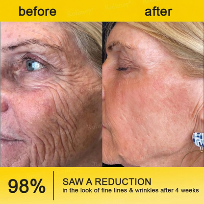 Wrinkle-Lift⬆️ Botox & Vita A Retinol Shot Tightening cream