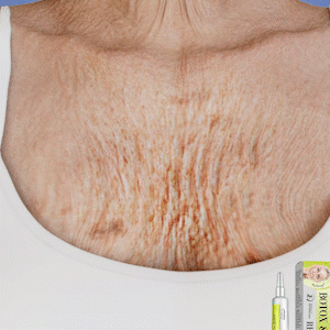 ✨Botox & Vita A Retinol Shot Wrinkle-Lift Tightening cream